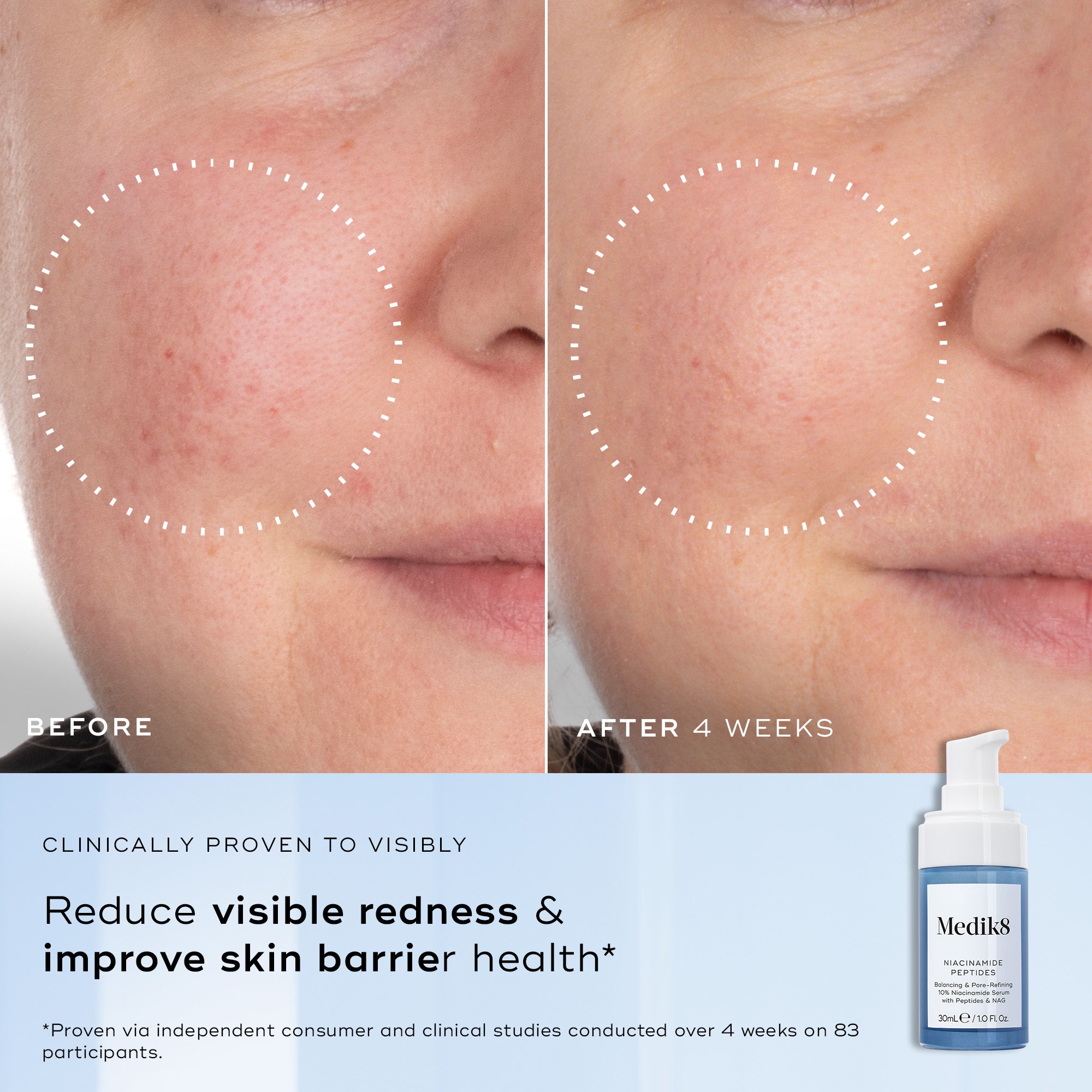 Medik8 Niacinamide Peptides