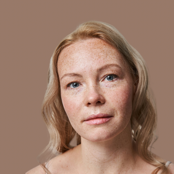 People Considering Advanced Acne Treatments