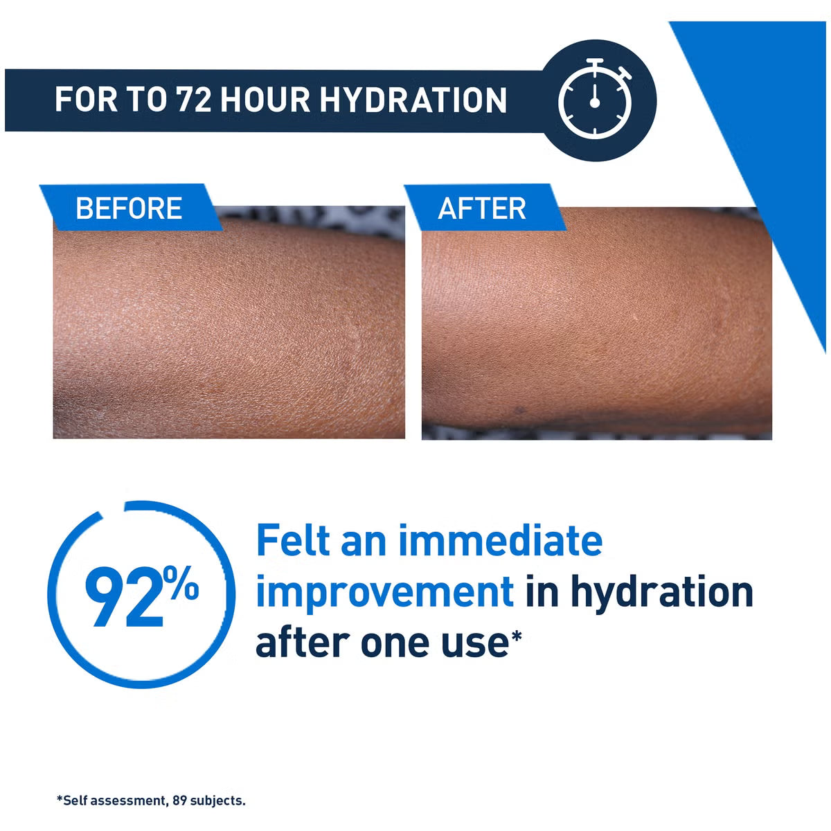 CeraVe Moisturising Lotion with Ceramides. Face and Body Lotion for Normal to Very Dry Skin 473ml